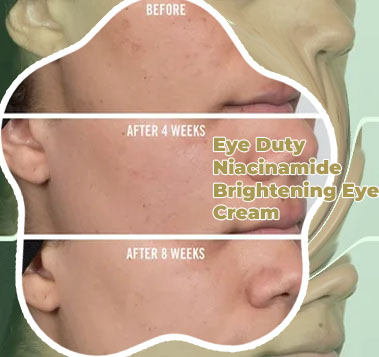 First aid beauty niacinamide eye cream