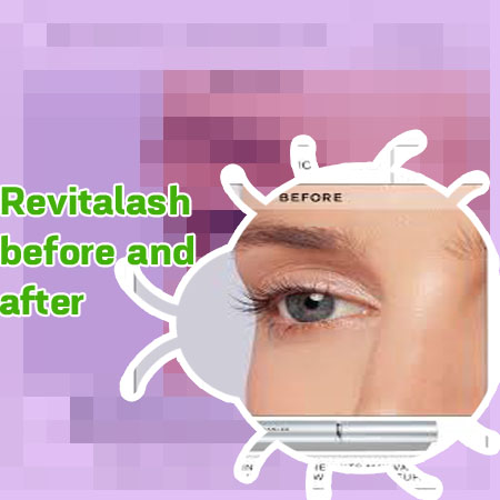 Revitalash eyelash serum before and after